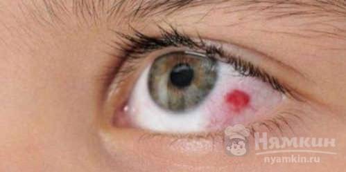 Попала пыль в глаз лечение thumbnail