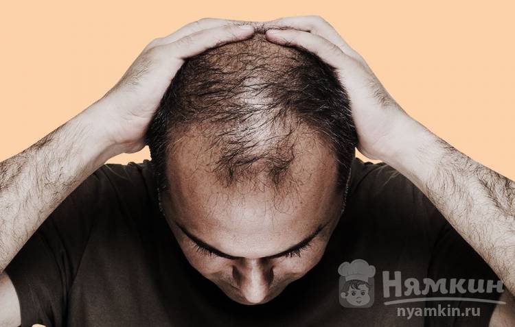 Выпадают волосы на теле у мужчин: что делать, как помочь себе